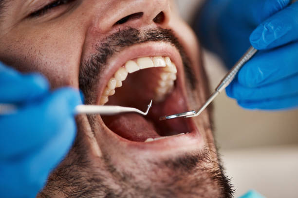 Best Broken or Cracked Tooth Emergency Dentist in Castroville, TX